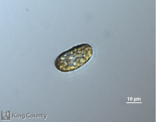 Photo of Heterosigma akashiwo